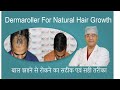 Dermaroller for hair fall | Hair fall treatment with dermaroller | Low cost hair fall treatment