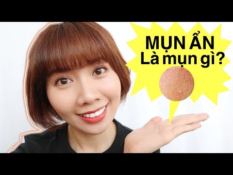 MỤN ẨN LÀ GÌ⁉️ | PHÂN LOẠI VÀ CÁCH ĐỐI PHÓ VỚI TỪNG LOẠI MỤN