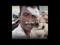 A man from Dahisar alleged that he was attacked by two to three unidentified men