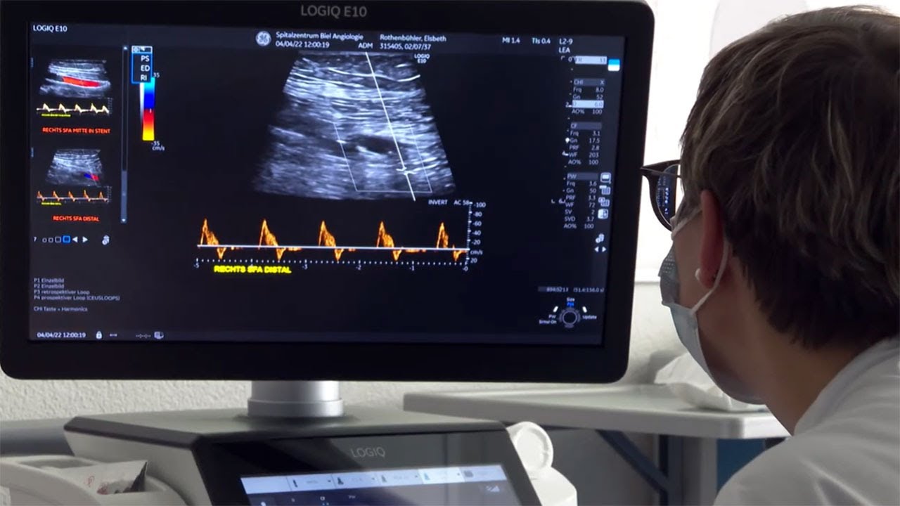 Centre vasculaire: Troubles circulatoire dans les jambes