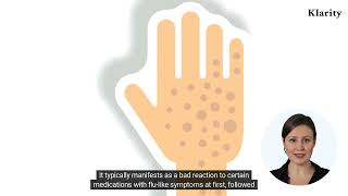 What Is Stevens Johnson Syndrome?