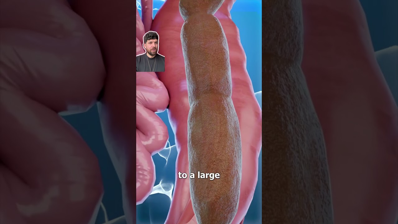 Испытывали ли вы когда-нибудь сильный запор?