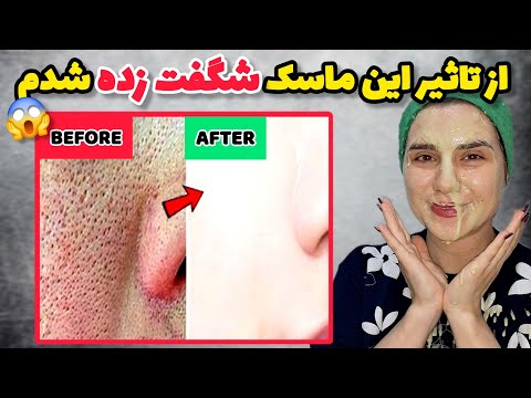 معجزه ماسک صورت با مخمر و خیار با آبرسانی منافذباز پوست رو میبنده روشن کننده و ضد چروک