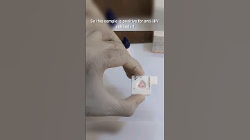 Step by Step Demonstration of HIV Testing Procedure #hivtest #hivtesting