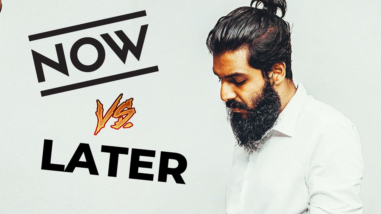 Waiting For The RIGHT TIME To Get A Hair System WATCH THIS YouTube