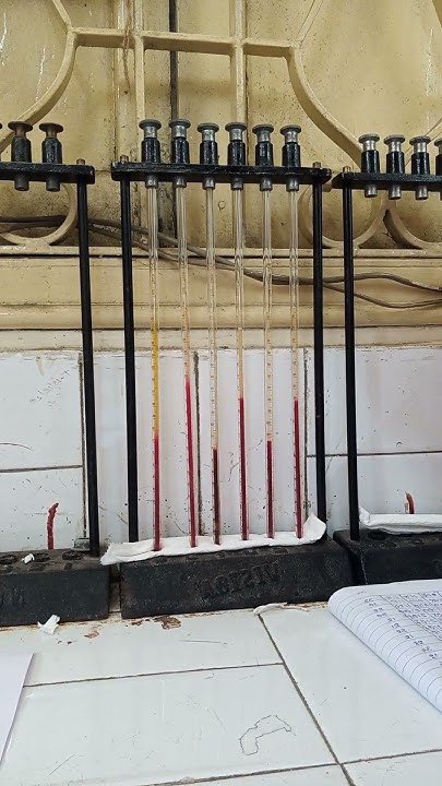 ESR(erythrocyte sedimentation rate).Westergren method#labtechnician # ...