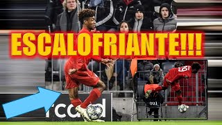 Escalofriante Lesion De Kingsey Coman