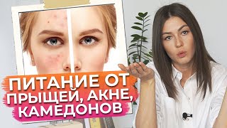 ЭТИ продукты вызывают ПРЫЩИ! / Как избавиться от прыщей навсегда?