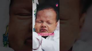 PGT-A Test | Preimplantation Genetic Testing in IVF | Dr. D. Maheshwari |Motherhood Fertility &amp; IVF