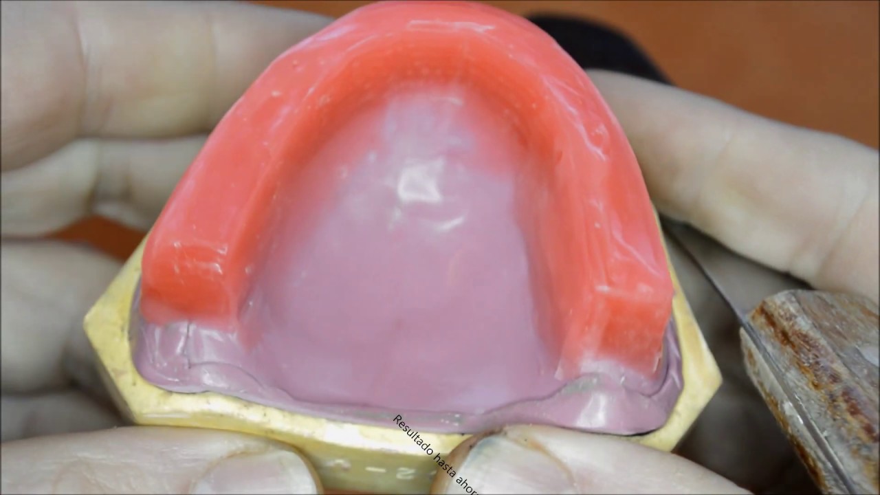 1 Placas de relación desdentado total