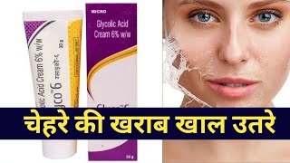 glyco 6 cream for melasma