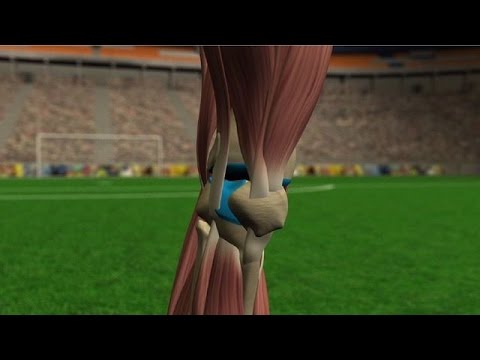 Video: 3 formas de romperse la rodilla