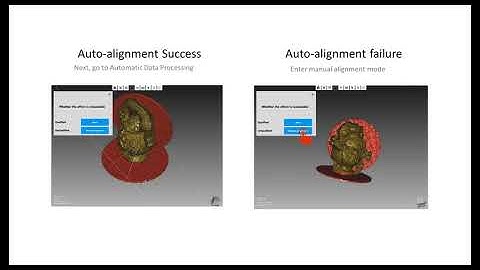 #CR-Scan 01#Basic Operation of CR Studio Software