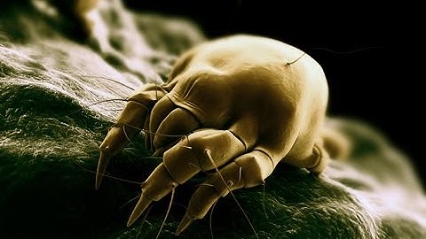 Dust Mites: Allergies & Asthma