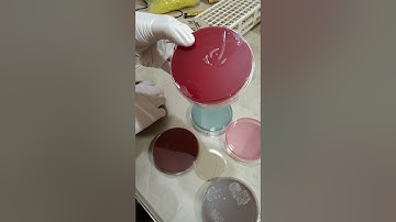 Identification of Culture Media