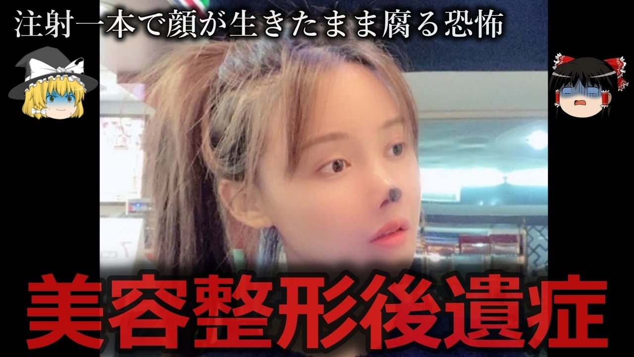 【ゆっくり解説】美容整形後遺症の悲惨な現実をゆっくり解説