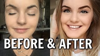 MICROBLADING MY EYEBROWS | Day 1 to Day 10 | My Experience & Advice