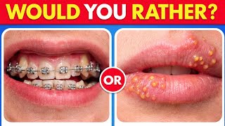 Only Genius Can Answer These 100 Would You Rather Questions 🧠🔥|| Epic Rather 
