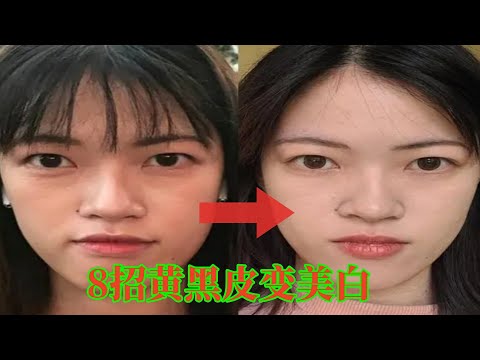 黃黑皮必看！皮膚科醫生都保密的8個變白好習慣，效果好又安全#祛斑 #穿搭教程#穿搭分享#時尚穿搭#健康常識#女性健康#養生保健#健康#健康飲食