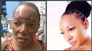 Palesa opens up about car accident