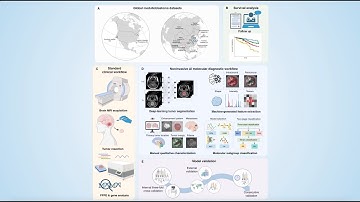 Advancing presurgical non-invasive molecular subgroup prediction in MB using AI and MRI signatures