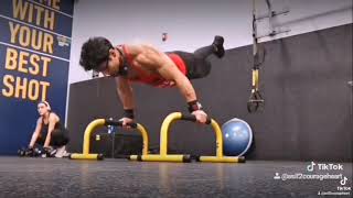 Left Leg Above Knee Amputee Model