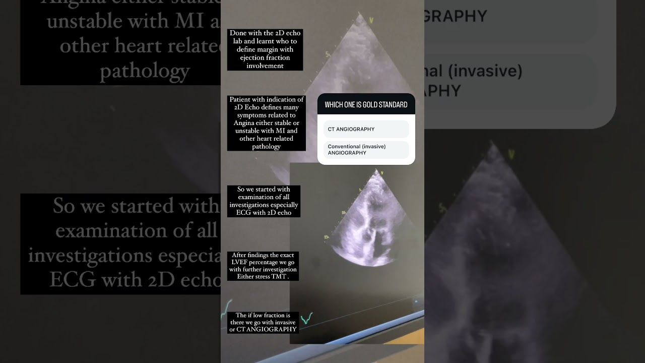 Comment on this if you know 🙌