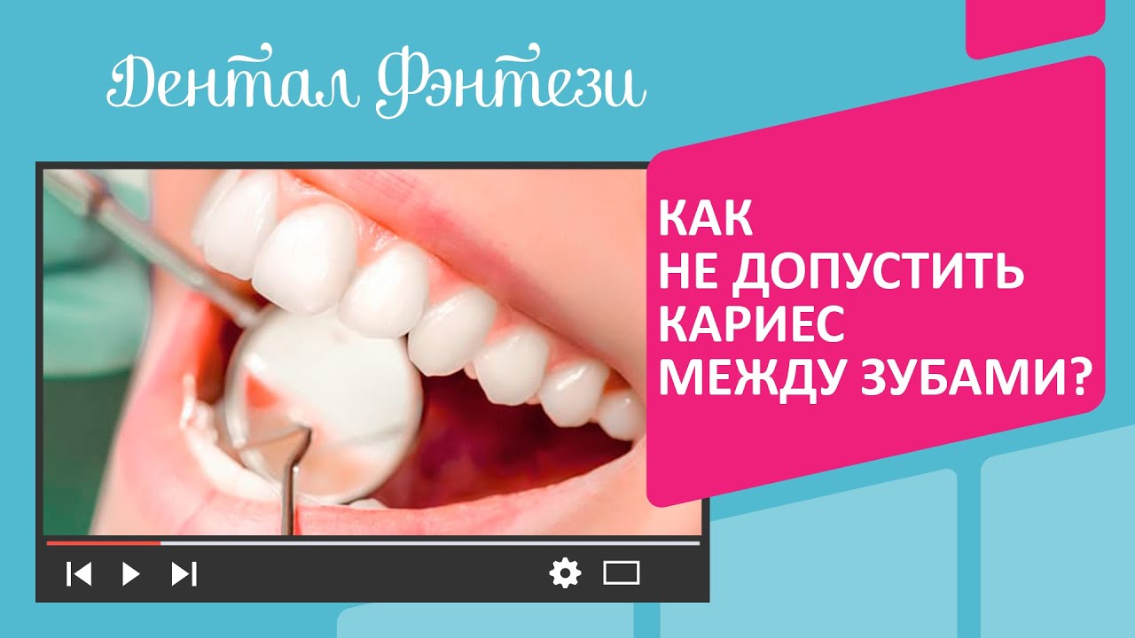 Как не допустить кариес между зубами❓🤔🦷