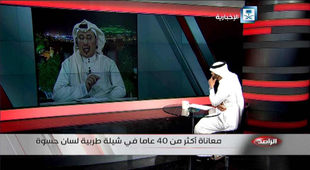 معاناة أكثر من 40 عاما في شيلة طربية لسان حسوة