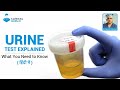 Urine test explained what you need to know