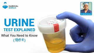 Urine Test Explained: What You Need to Know