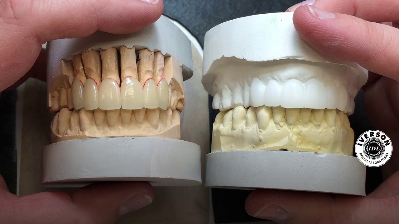 How to make small teeth show more when smiling Dentist in