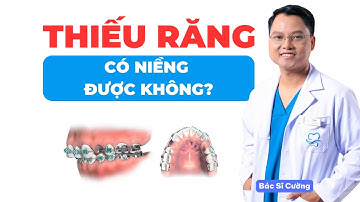 Thiếu răng thì có niềng được không?  |Dr Cường Official