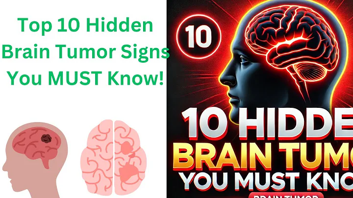 "10 Alarming Signs of a Brain Tumor You’re Ignoring – Could It Be Happening to You?"