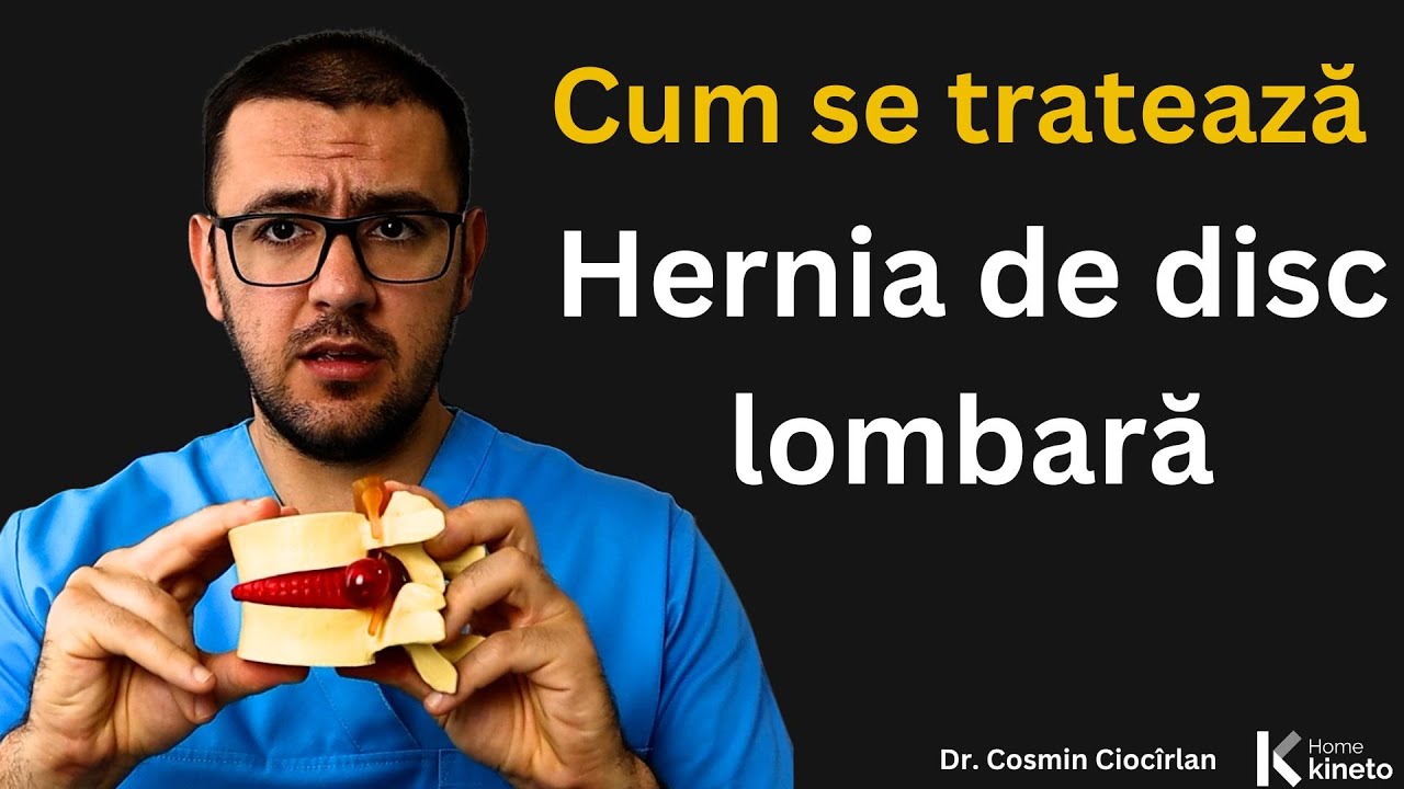 Hernia de disc Lombară Planul de tratament
