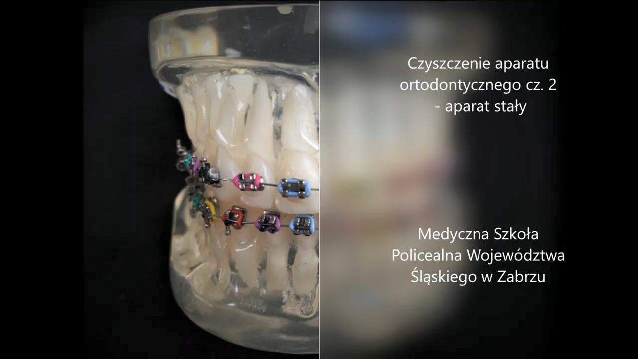 Czyszczenie aparatu stałego
