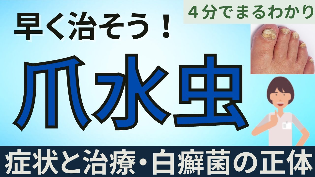 早く治そう！爪水虫の症状と治療法、白癬菌の実態まで！４分でまるわかり♪