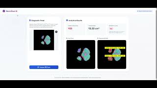 NeuroScan AI: Multi-Instance Brain Tumor Segmentation & Sizing Pipeline
