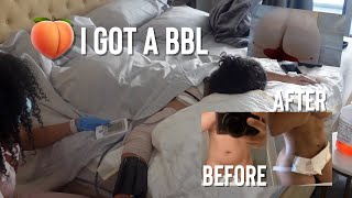 NEW BODY WHO DIS?... I GOT A BBL & 360 LIPO ... HERES WHAT HAPPEN | KIRAH OMINIQUE