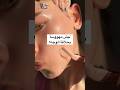 إزالة شعر الوجه بالشفرة مين جربها 