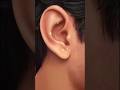 😱 Most Satisfying Ear Cleaning Ever! Watch Till End 👂✨ #shorts