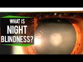 Retinitis pigmentosa and disability certificate #disabilitycertificate #eyediseases #nightblindness