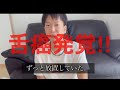 舌癌に気づいたきっかけを話します‼︎