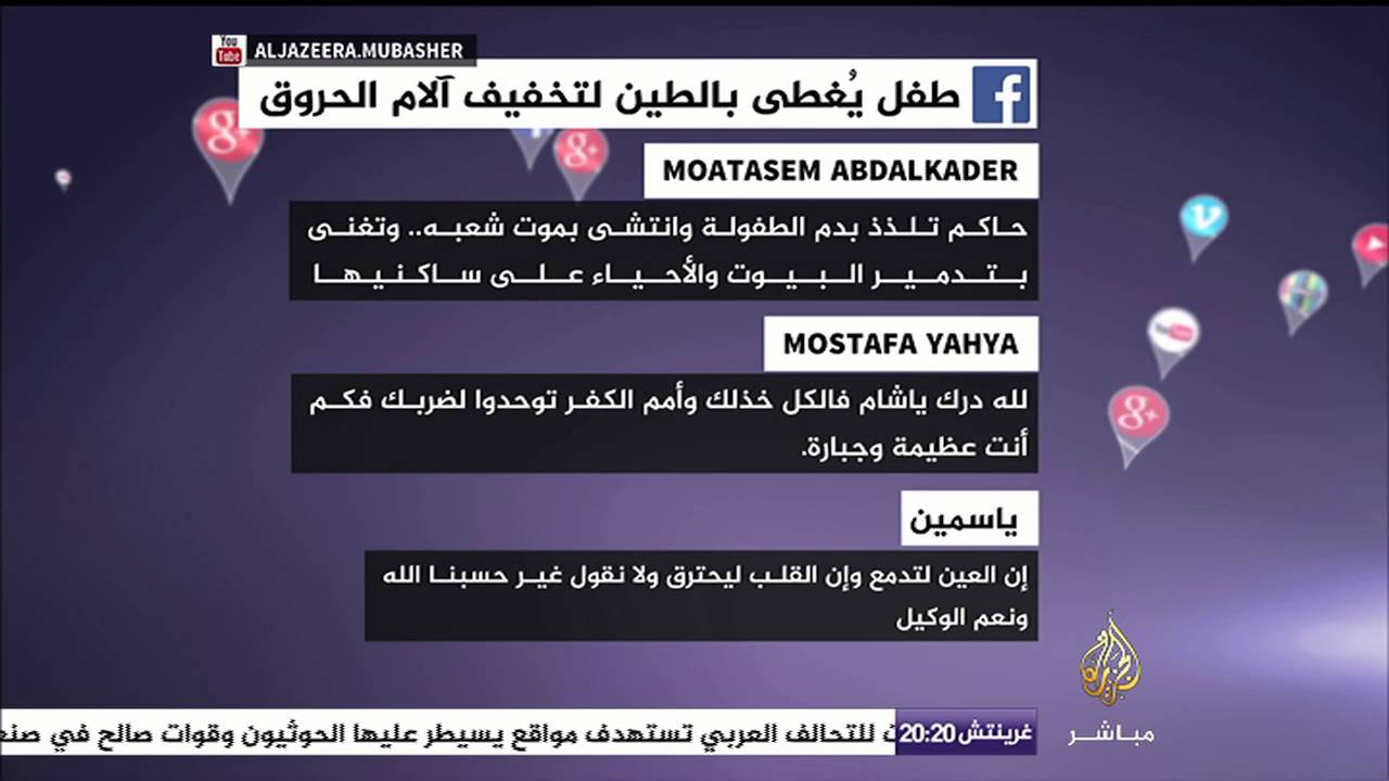 ترتعش يداه من لهيب الحروق، فوضعوا الطين على رأسه لتخفيف حرارتها