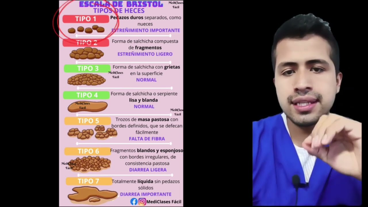 Escala De Heces De Bristol😚 Descubra o emocionante mundo das apostas