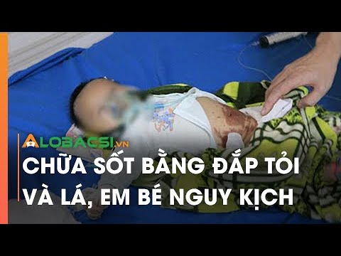 Chữa Sốt Bằng Đắp Tỏi Và Lá, Em Bé Nguy Kịch