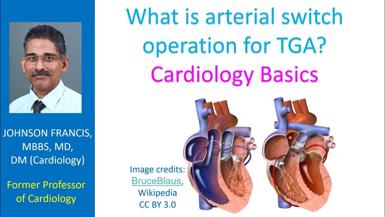 What is arterial switch operation for TGA? Cardiology Basics YouTube