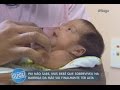 Gugu conta a história do bebê que cresceu na barriga da mãe com morte cerebral