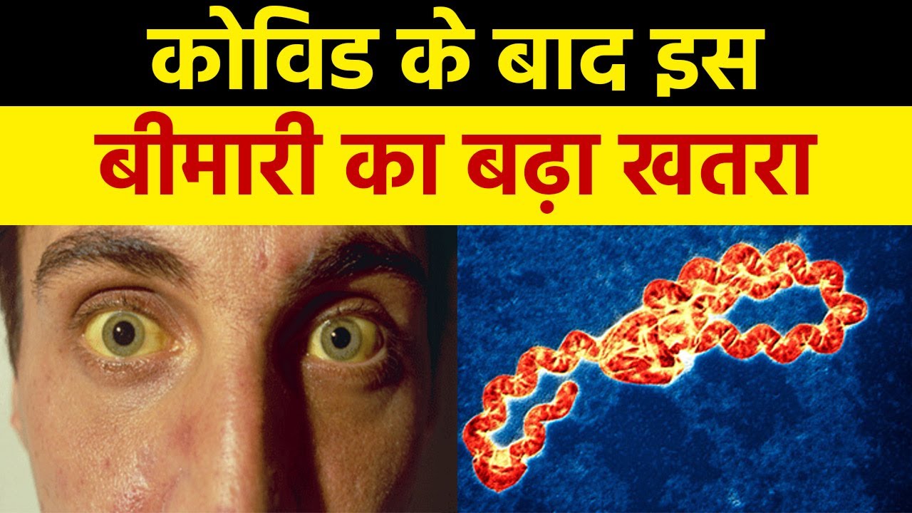 ⁣Leptospirosis Infection का बढ़ा खतरा , जानें इसके Symptoms और बचाव के उपाय । Boldsky