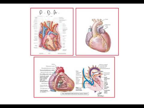 Heart development 5